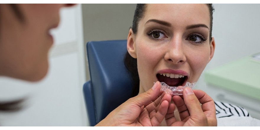 Ortodonti tedavisinde diş tellerinin yerini şeffaf plaklar alıyor