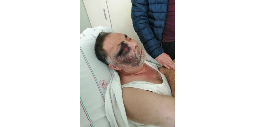 Engelliyi döverek öldürmekle suçlanan baba-oğlun beraatine itiraza ret