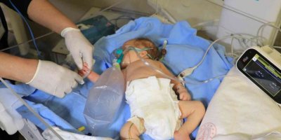 Ambulans helikopterle Adana’ya getirilen minik Ahmet’in durumu iyi