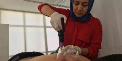 Gölhisar Devlet Hastanesinde “Kupa ve Akupunktur“ tedavisi başladı