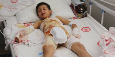 Okuldaki etkinlikte 6 yaşındaki öğrencinin üzerine kaynar su döküldü