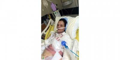 Dezenfektanın parlamasıyla yanan Havva, 75 gündür yoğun bakımda