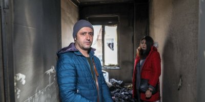 Ameliyat için biriktirdikleri para, yangında yandı