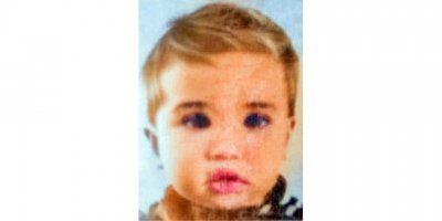 Antalya'da kolu ampute edilmekten kurtarılan Yunan kız, 1 ay hastanede kalacak