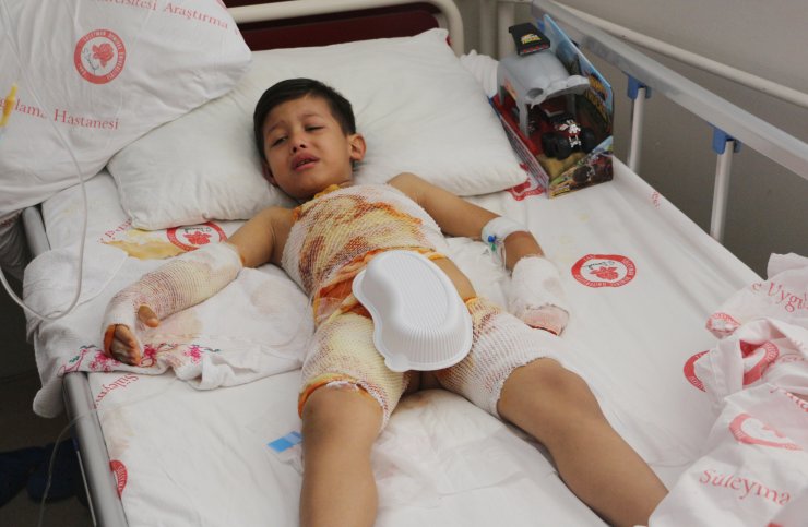 Okuldaki etkinlikte 6 yaşındaki öğrencinin üzerine kaynar su döküldü